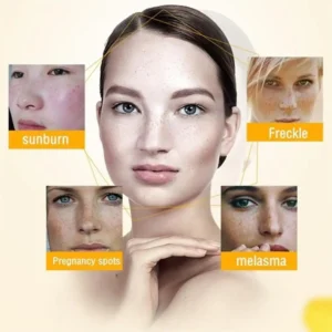 Alternative view of Freckle Whitening Cream