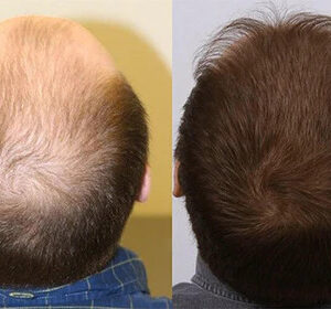 Ginger Hair Regrowth Shampoo Bar