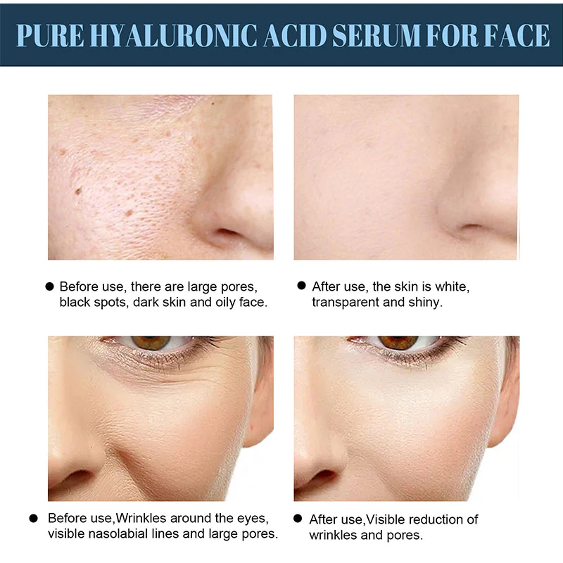 ProFirm Korean Soluble Protein Thread