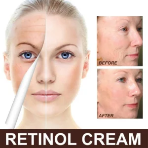 Retinol Anti Aging Face Cream & Essence
