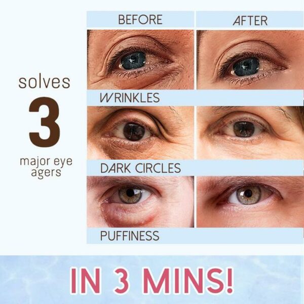 Kem dưỡng mắt phục hồi Revitaleyes™