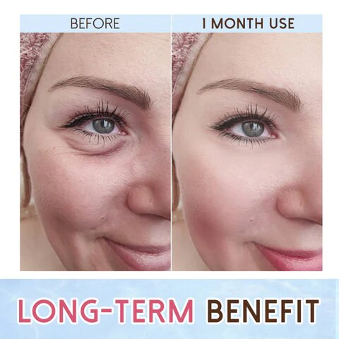 Revitaleyes Repair Eye Cream