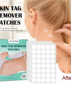 Skin Tag Remover Patch 120 Pcs