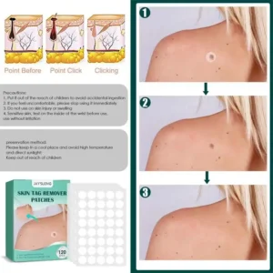 Skin Tag Remover Patch 120 Pcs