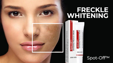 Spot-Off™ Freckle Whitening Cream