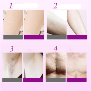 SprayAway Hair Removal Spray