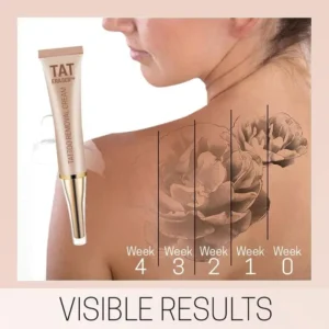 TatEraser™ Tattoo Removal Cream