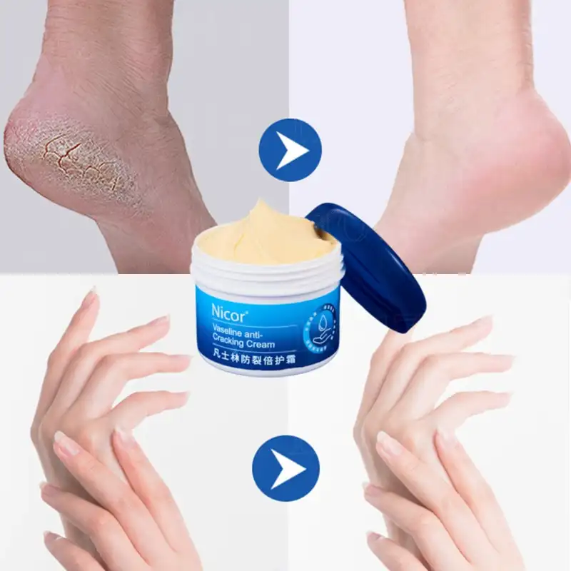 Vaseline Anti Cracking Cream