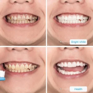 Viaty Stain Removal Whitening Toothpaste