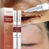 2Pcs Tags & Moles Remover
