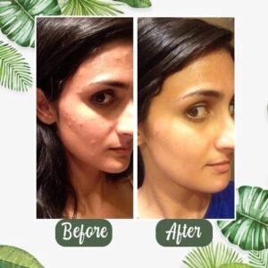Free-Deep Cleanse Green Tea Mask