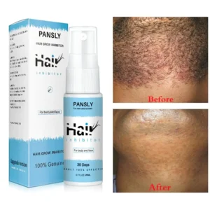LolaLife- Semi-Permanent Hair Removal Spray