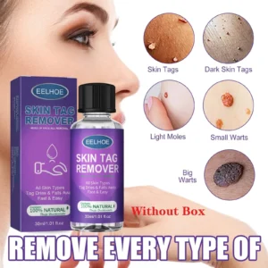 Organic SkinTag Solution