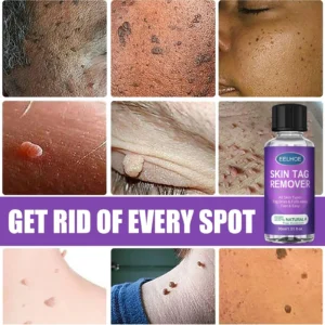 Organic SkinTag Solution