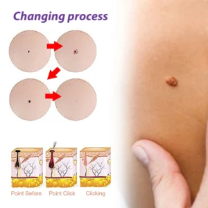 Organic SkinTag Solution
