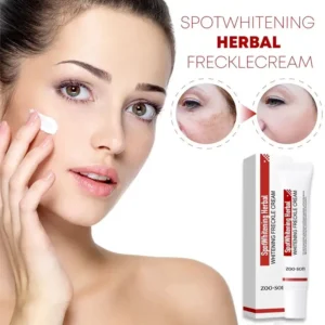 Spot Whitening Herbal Freckle Cream
