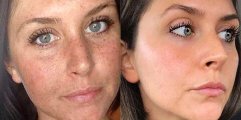 Spot Whitening Herbal Freckle Cream