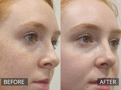 Spot Whitening Herbal Freckle Cream