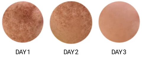 Spot Whitening Herbal Freckle Cream
