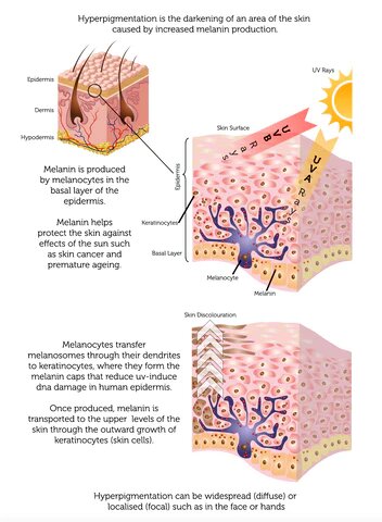 Spot Whitening Herbal Freckle Cream