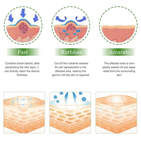 Spot Whitening Herbal Freckle Cream