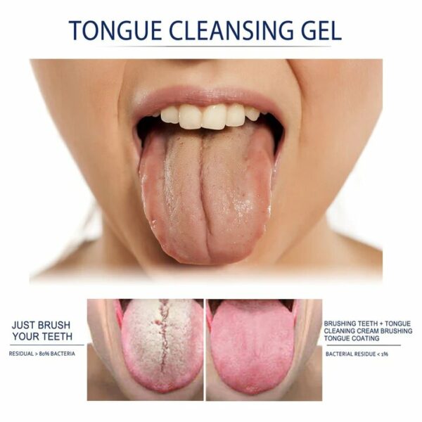 Tongue Cleansing Gel Set