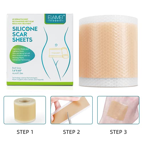 ELAIMEI™ Medical Soft Silicone Gel Tape para sa Pagtangtang sa Scar
