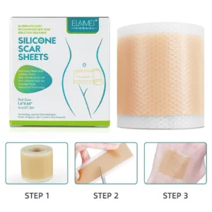 Alternative view of Medical Soft Silicone Gel Tape for Scar Removal (1.6” x 60”）