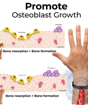 SMF Osteoporosis Therapy Bracelet