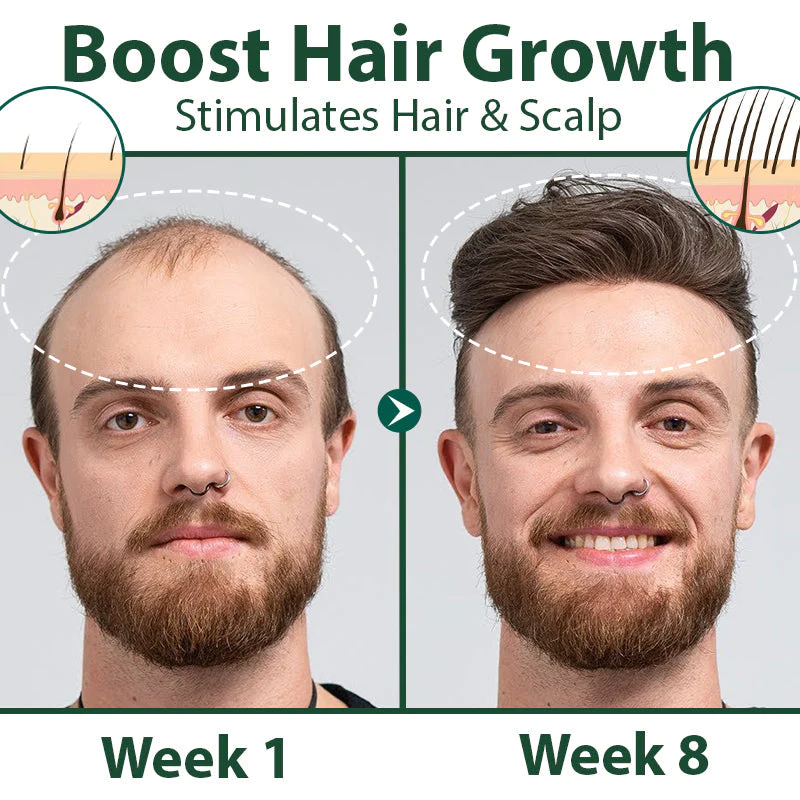 CKTUING HAIR GROWTH SERUM 2.0 - Image 3