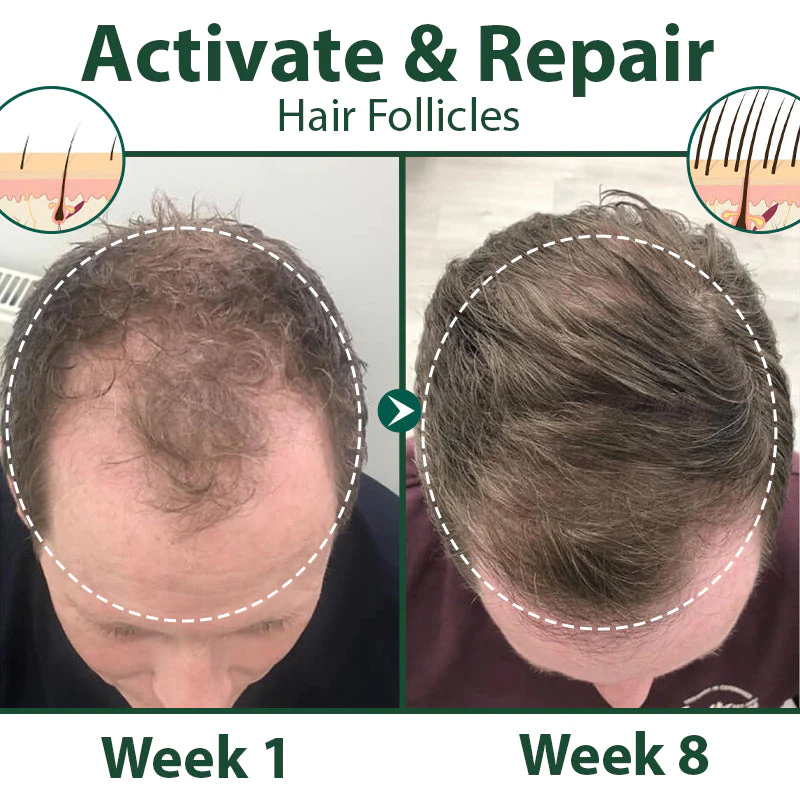 CKTUING HAIR GROWTH SERUM 2.0 - Image 4