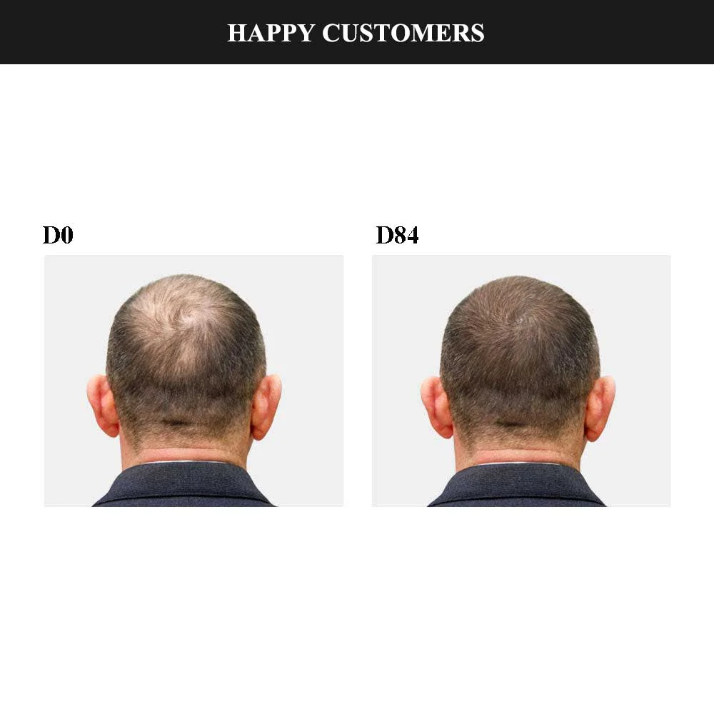 CKTUING HAIR GROWTH SERUM 2.0 - Image 5