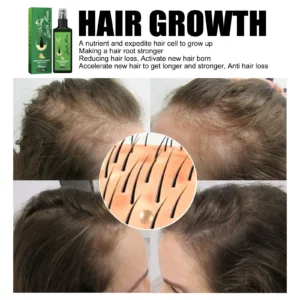 Alternative view of GrowthPlus Jaysuing Hair Spray - ultimate solution” for hair loss