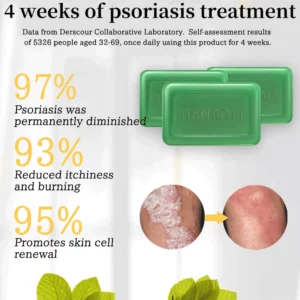Alternative view of HANBOLI™ Herbal Psoriasis Treatment Soap