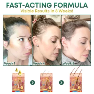 Alternative view of HyunGang Korean Ginseng HairReborn SerumSpray