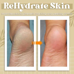 Alternative view of JaySuing™ Anti Fungal Treatment Spray