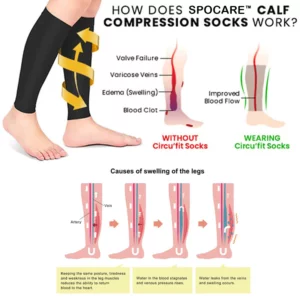Alternative view of SPOCARE™ Thermally Cycling Self-Shaping Compression Socks