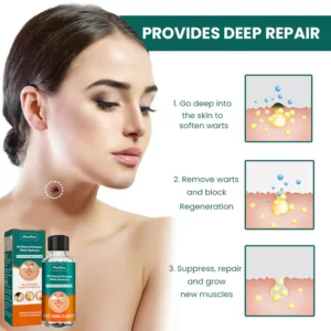 Alternative view of SimpClear All Natural At-Home Warts Remover