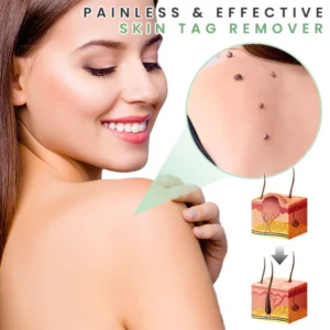 Alternative view of AMORIE SKINTAG'Gone Patch