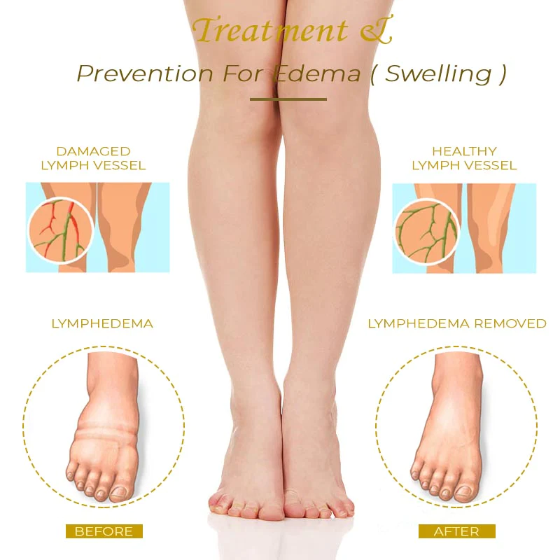 AntiSwelling BodySlim GingerHot Cream - Image 4