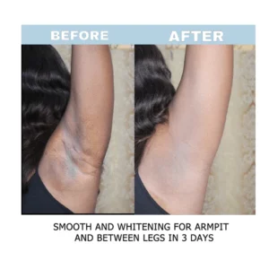 Alternative view of BELLEZON™ Body Care Brightening Cream