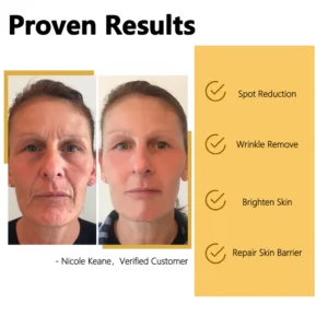 Alternative view of Calendula 30 Days Anti-Aging Peel Off Mask