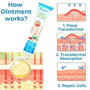 Alternative view of CurSkin™ Lipoma Treatment Ointment