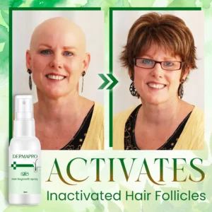 Alternative view of DermaPRO Hair Regrowth Spray