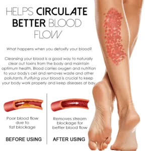 Alternative view of DetoxCARE LymphaticDrain FootPatch