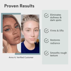 Alternative view of Faues™ Skin Brightening Anti-Spot Serum