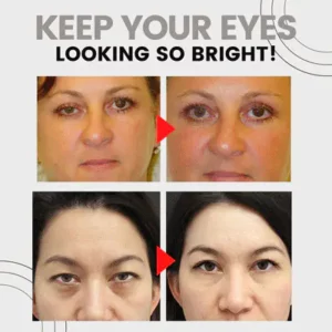Alternative view of FlipBeauty™ Enhancing Eye Lift Serum