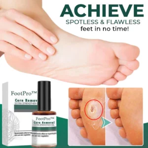 Alternative view of FootPro™ Corn Removal Extra Strengthen Gel