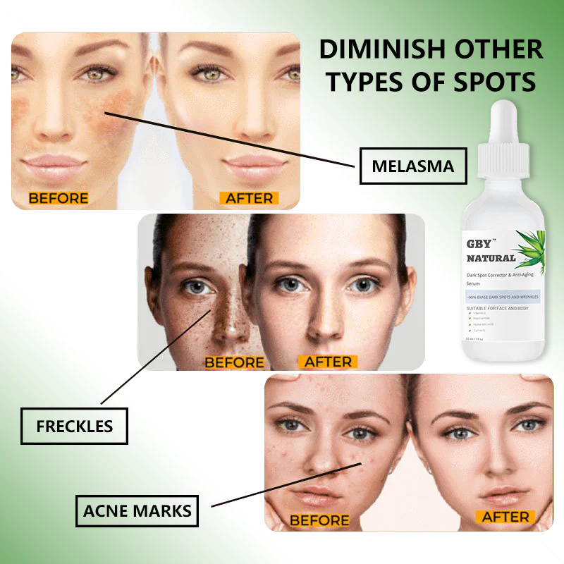 GBY™ Dark Spot Corrector & Anti-Aging Collagen Serum - Image 4