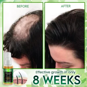Alternative view of GinCare Hair Nutrition Spray